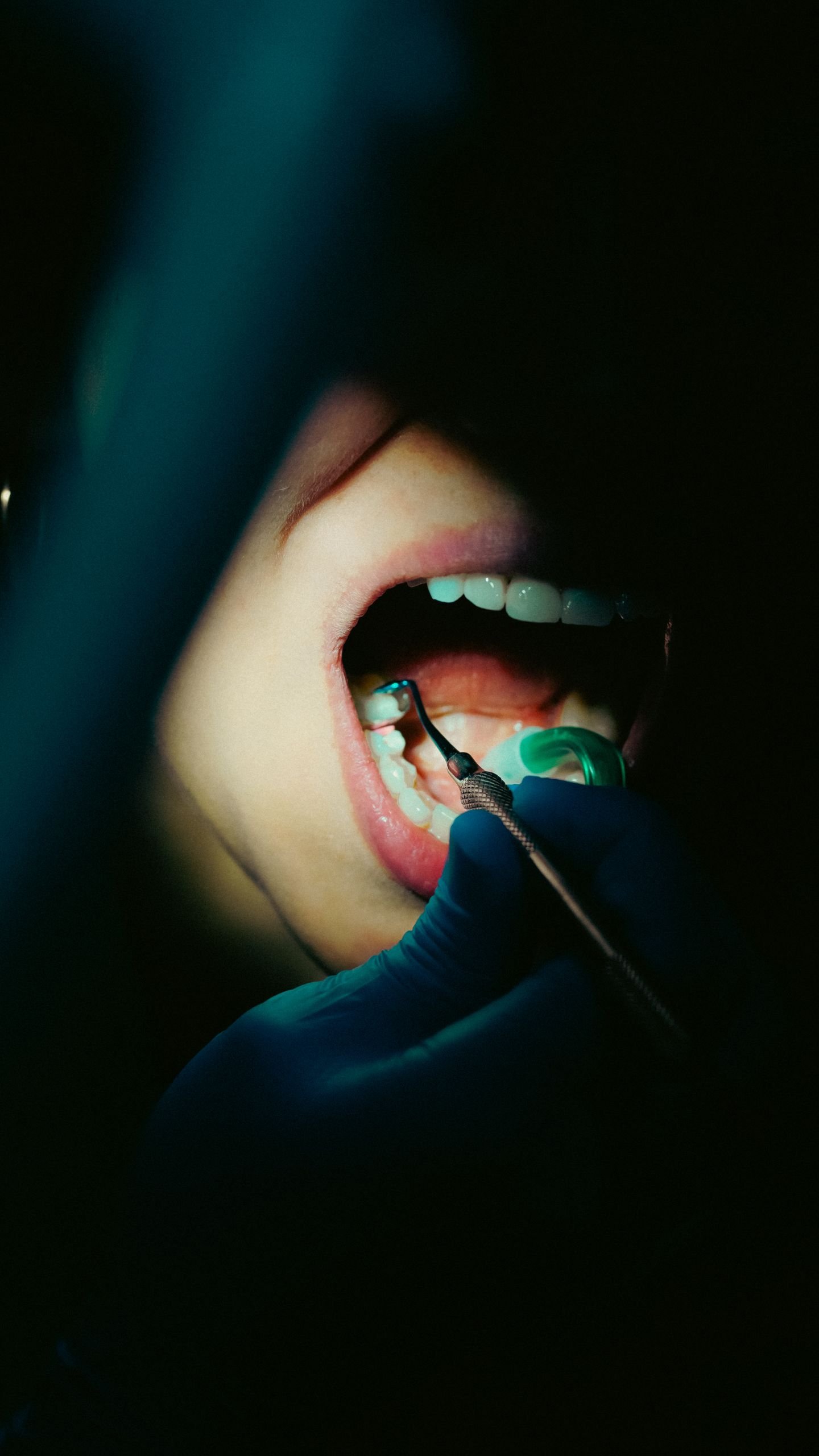 Detailed close-up of a dental examination with dental tools, showcasing oral hygiene.